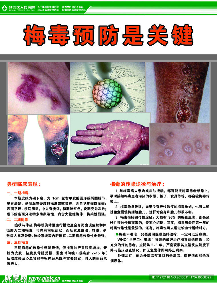 梅毒预防是关键