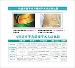 传统与微创手术对比图