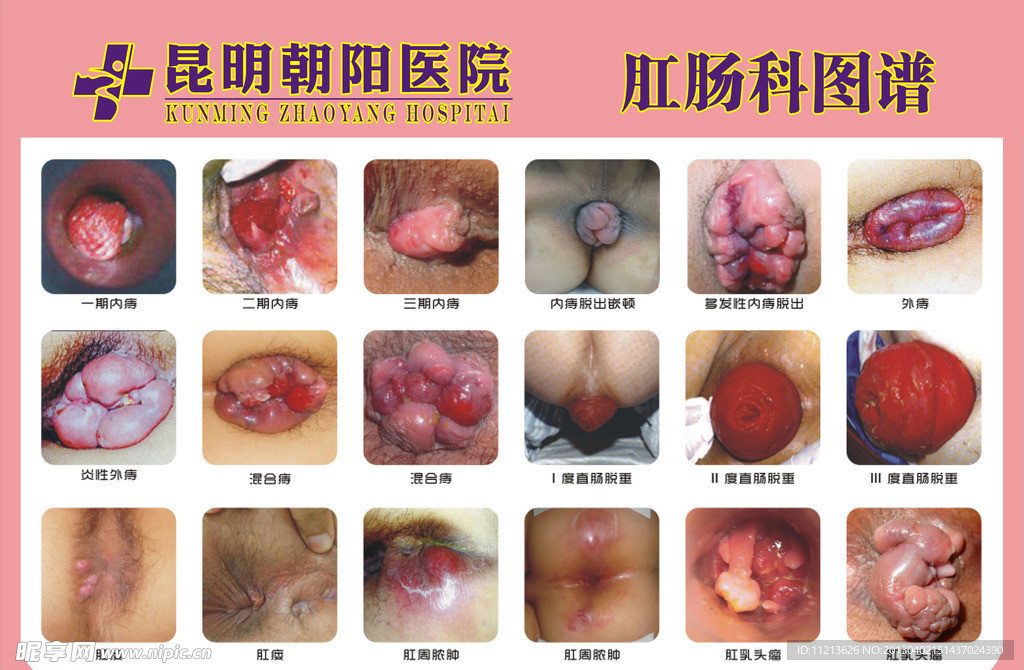 肛肠疾病图谱