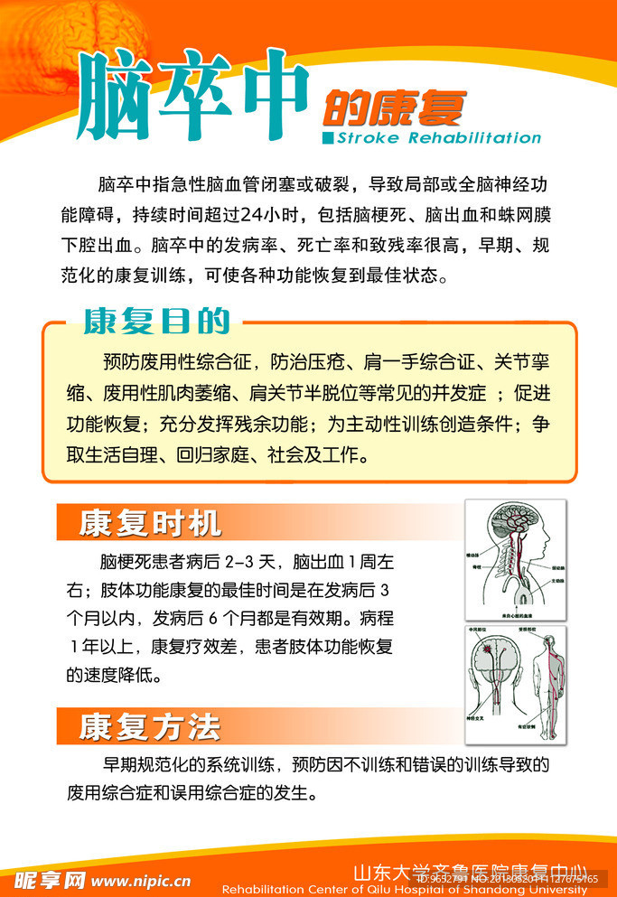 脑中卒的说明