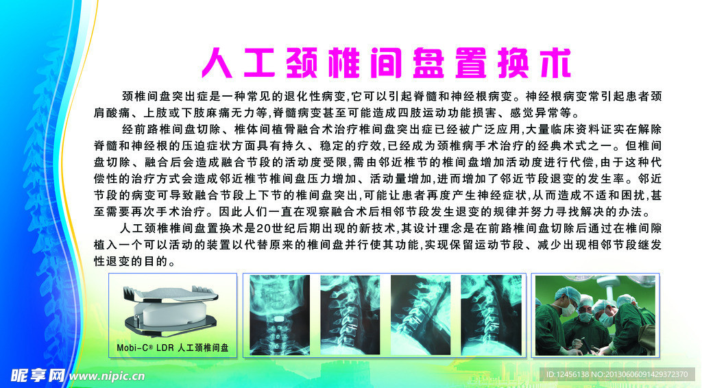 人工颈椎间盘置换术