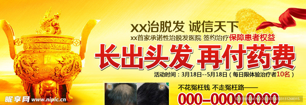 医疗 治脱发banner