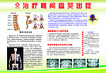 治疗椎间盘突出症