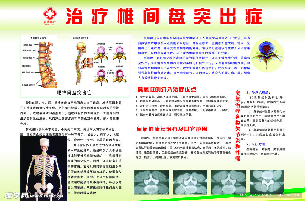 治疗椎间盘突出症