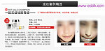 百莲凯祛斑对照图