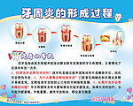 洗牙 牙科展板