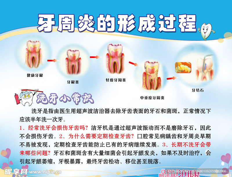 洗牙 牙科展板