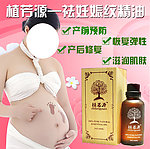 植芳源祛妊娠纹精油