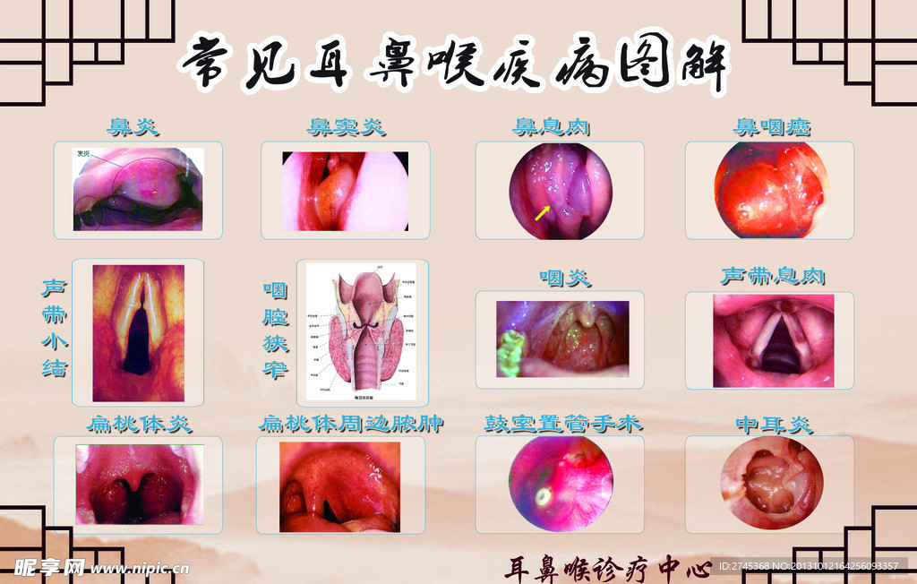 耳鼻喉症状图