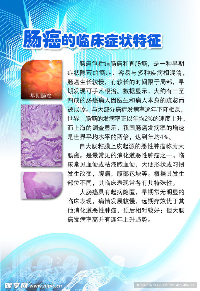 癌症的临床症状特症