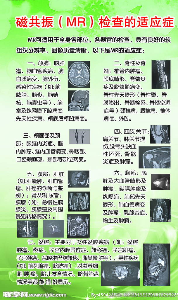 磁共振检查的适应症