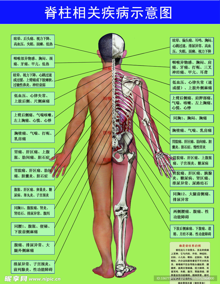 脊柱相关疾病示意图