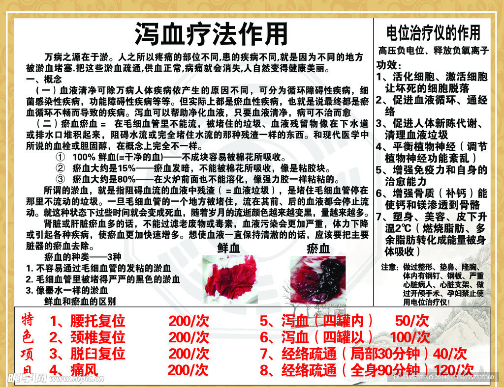 泻血疗法作用