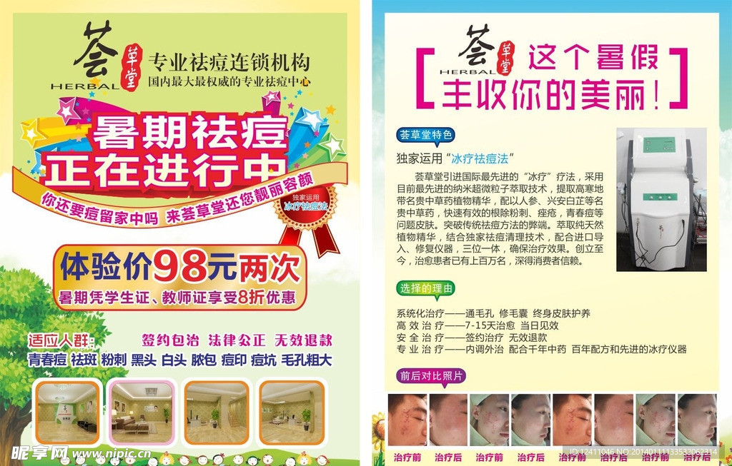 祛痘宣传单