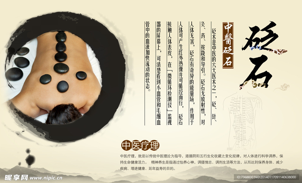 砭石