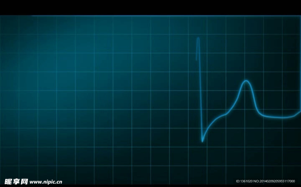 心电图视频素材