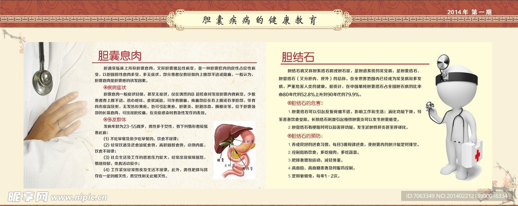 胆结石展板