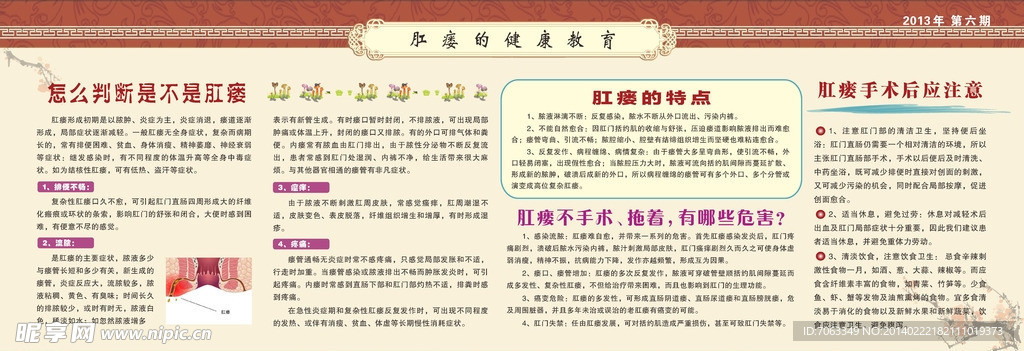 女性 肛瘘教育知识