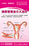 输卵管导丝介入治疗