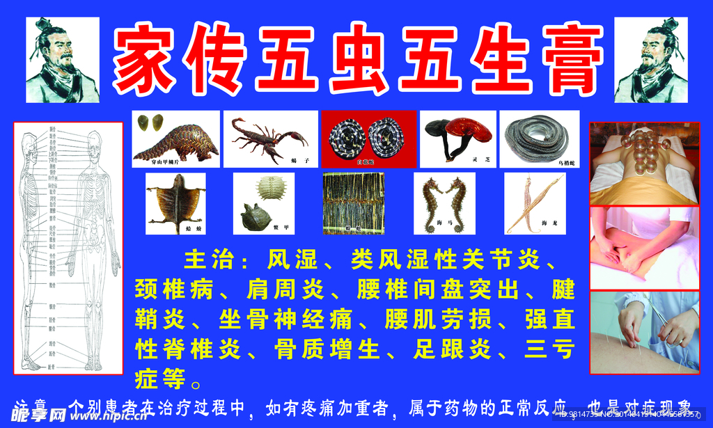 五虫五毒