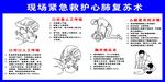 现场紧急救护心肺复苏