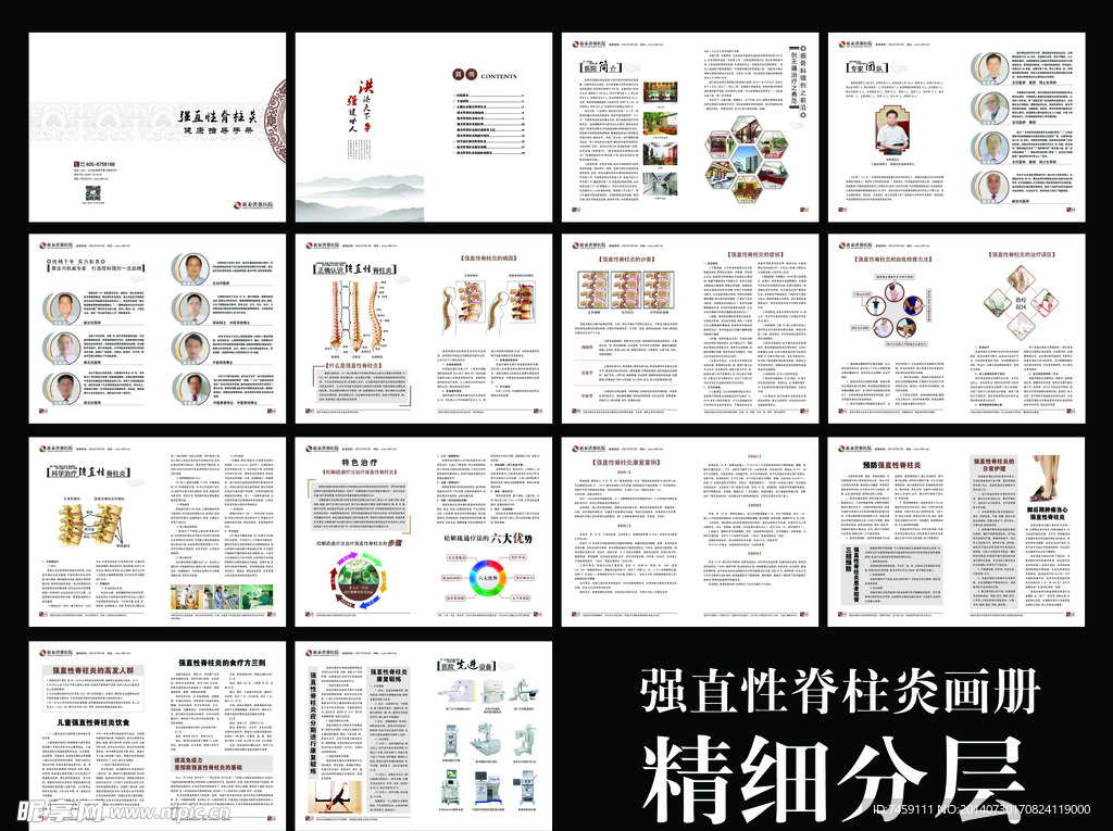 强直性脊柱炎画册