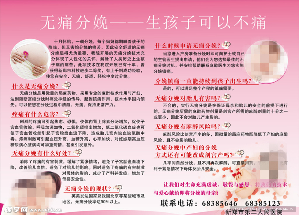 无痛分娩