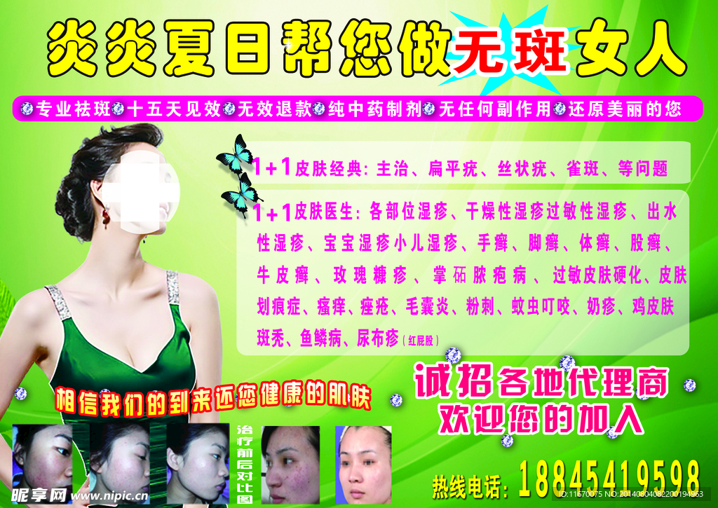 无斑女人