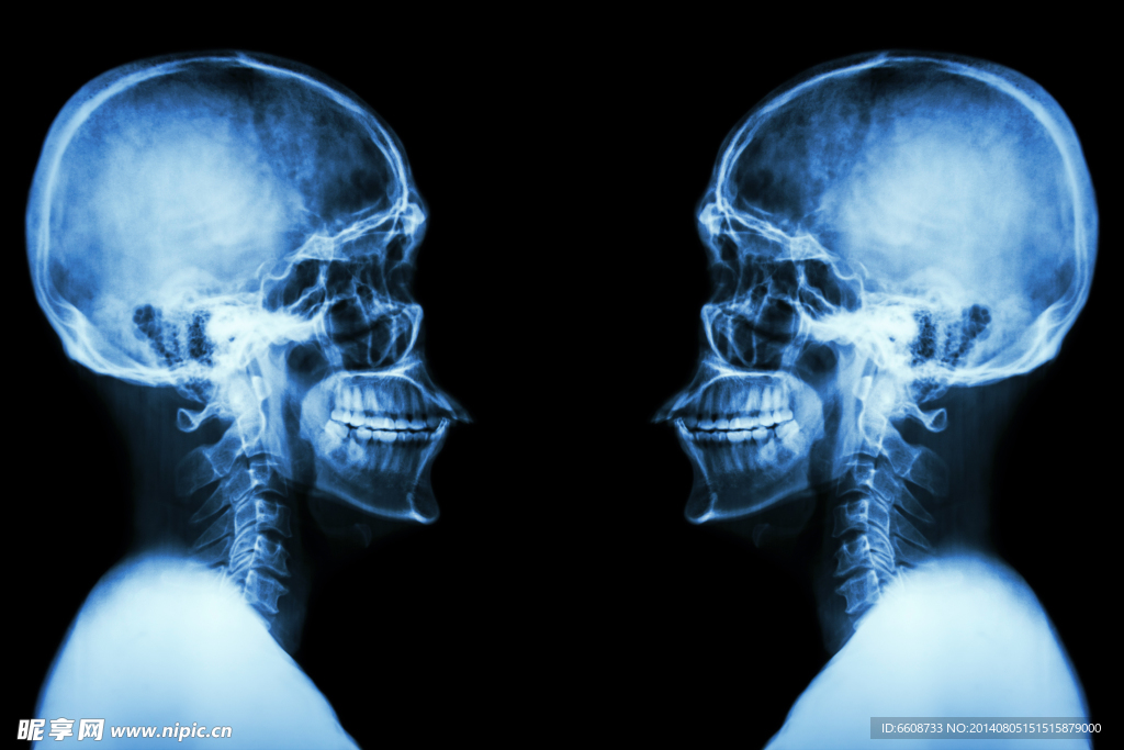 大脑X光片
