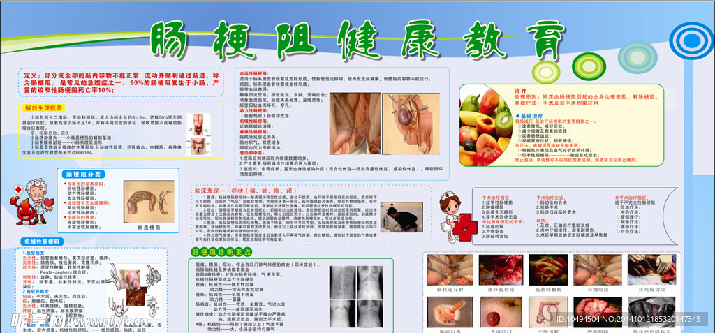肠梗阻健康教育
