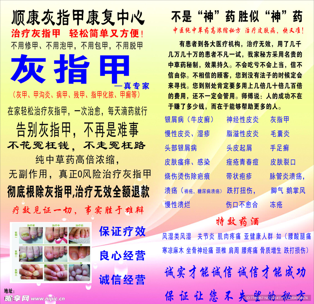 灰指甲广告