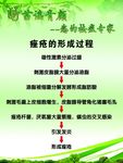 苗瑶青颜痤疮形成过程