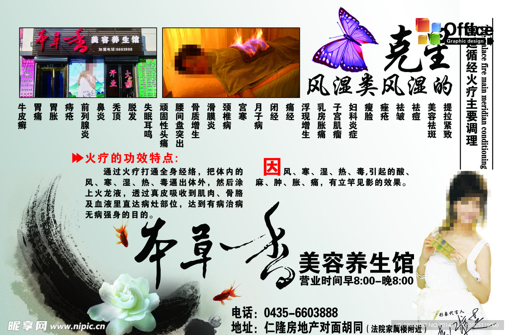 火疗