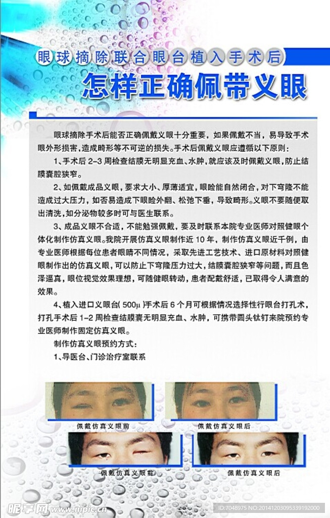 正确佩戴义眼