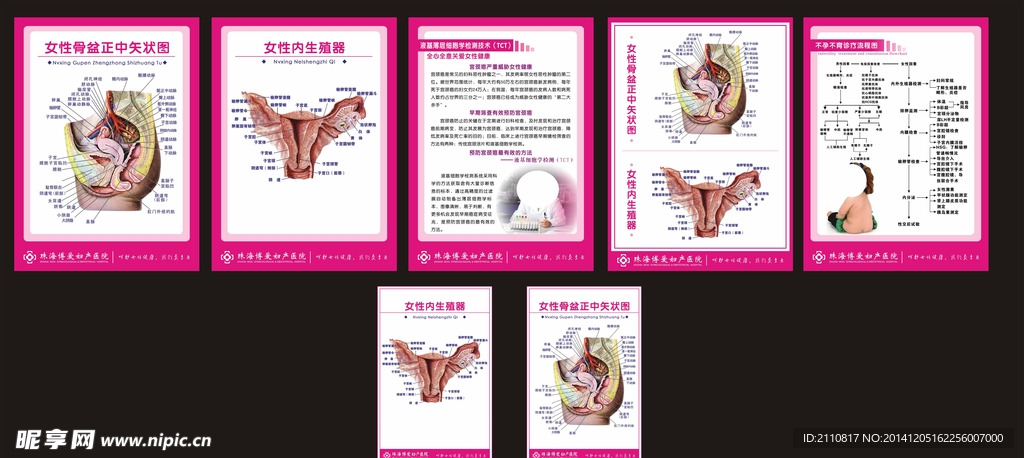 女性生殖解剖图