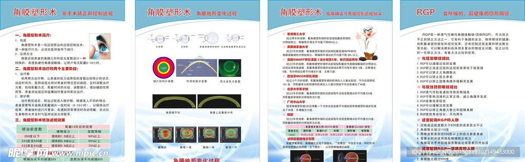 角膜塑形术