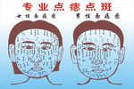 点痣