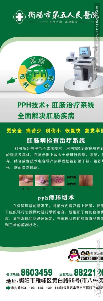 PPH痔疮展架