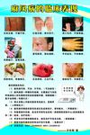 麻风病十大临床表现