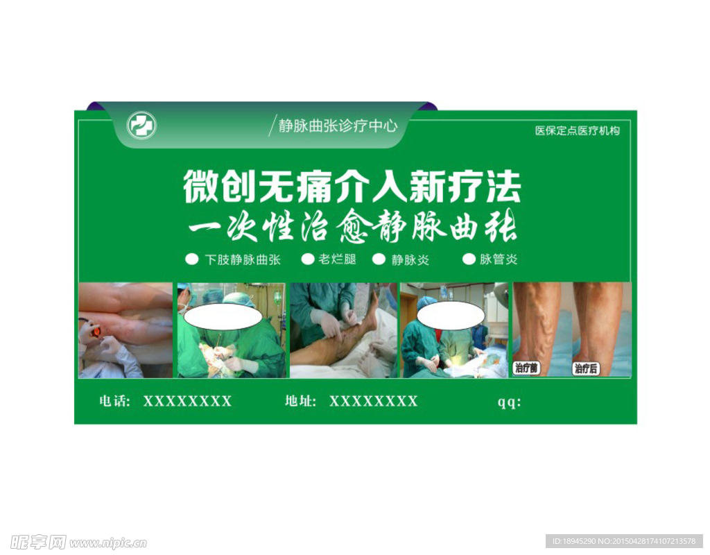 静脉曲张广告
