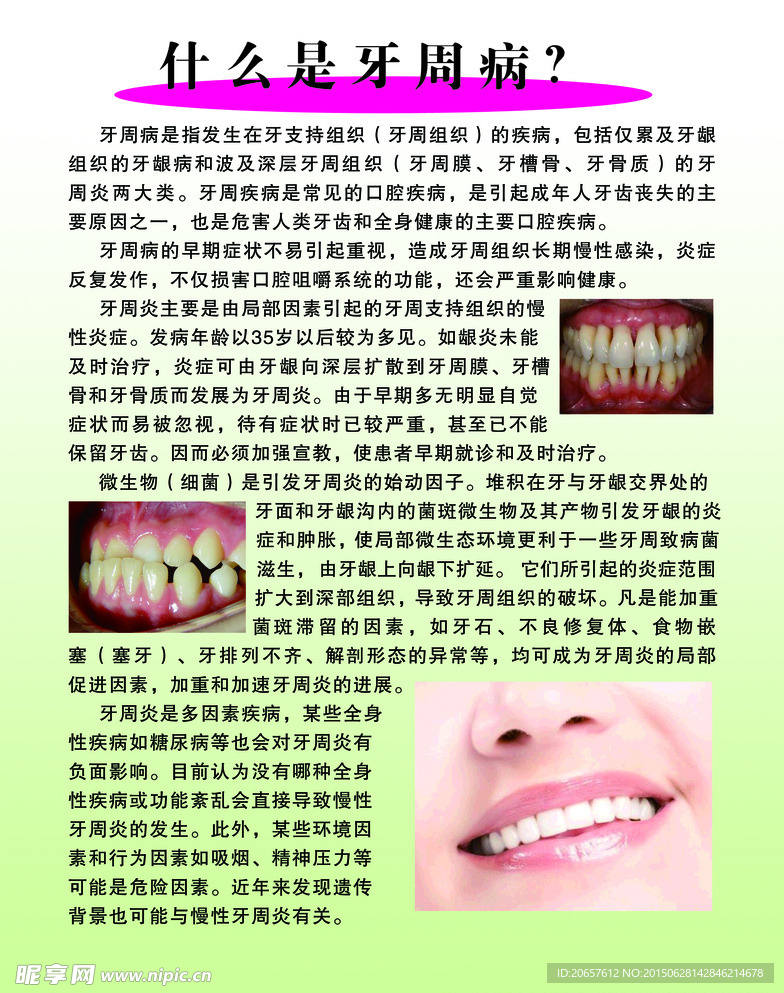 牙周病