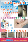 冰点脱毛