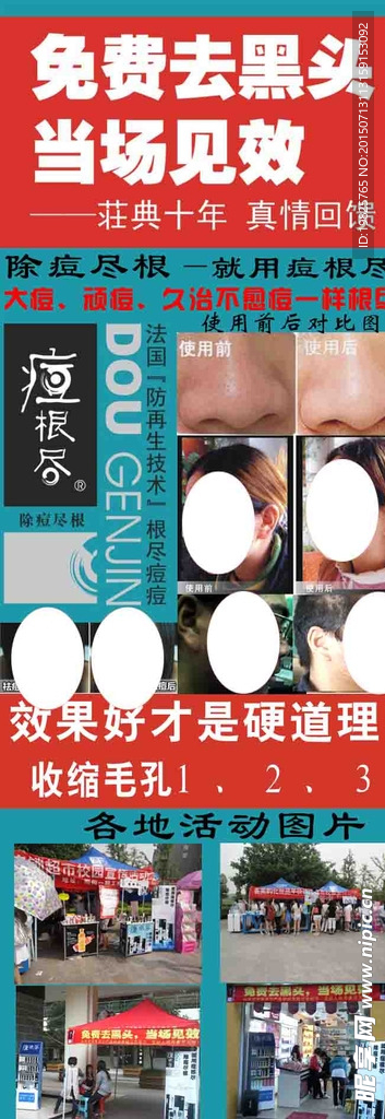 痘根尽活动展架