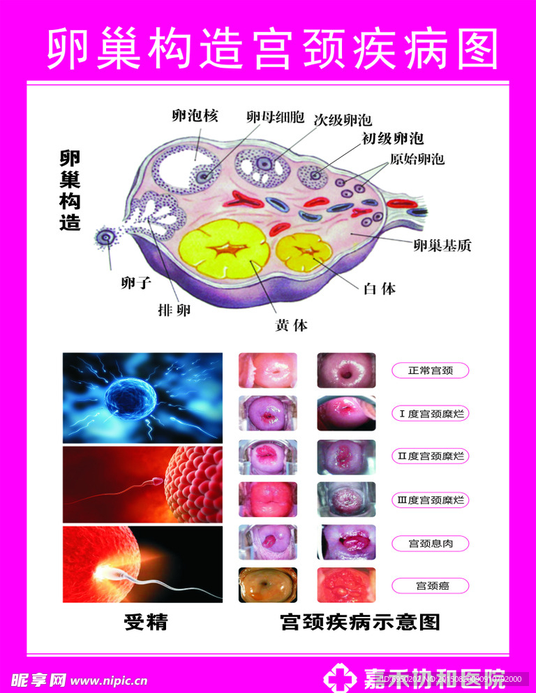 卵巢构造宫颈疾病图