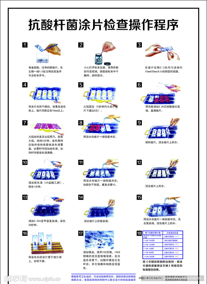 抗酸杆菌涂片检查操作程序