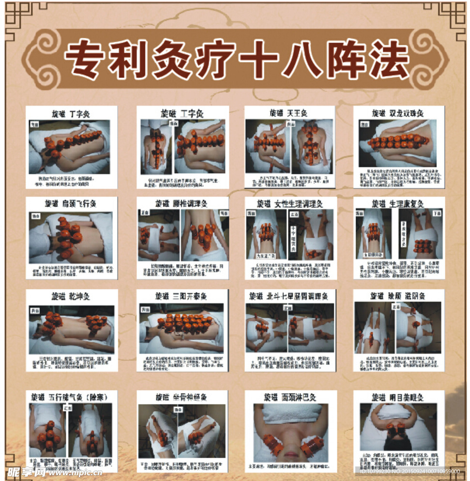 针灸