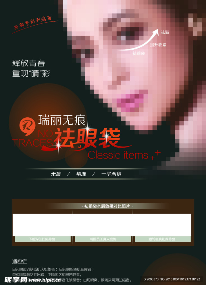 祛眼袋
