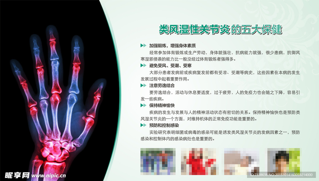 类风湿性关节炎的五大保健