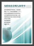 角膜移植