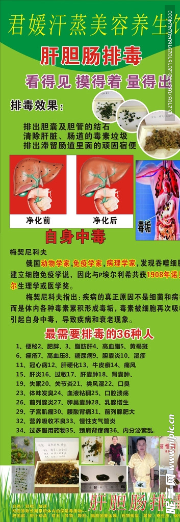 X展架  肝胆肠排毒  养生